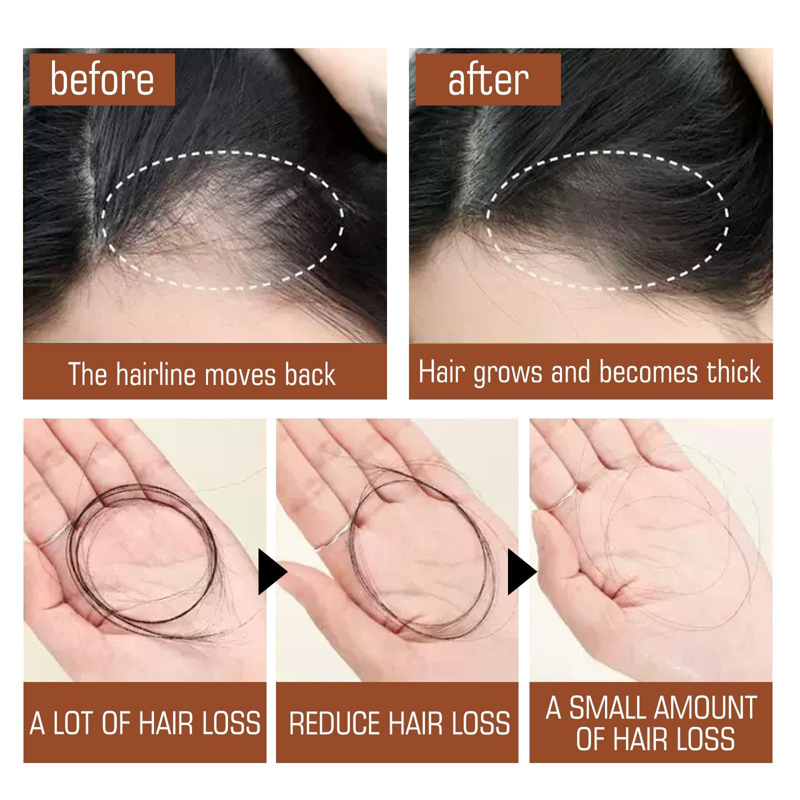 Batana Oil From Honduras Hair Nutrition