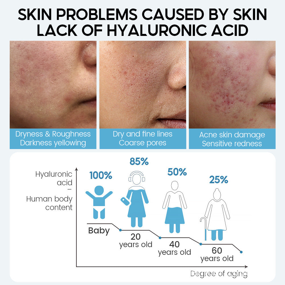 Moisturizing Face Cream for Dry Skin